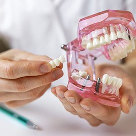 a dentist holding a model of dental implants